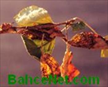 سوختگی ریسمانی